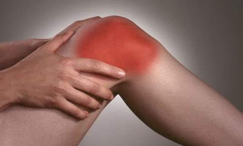 Проблема артрита коленного сустава
